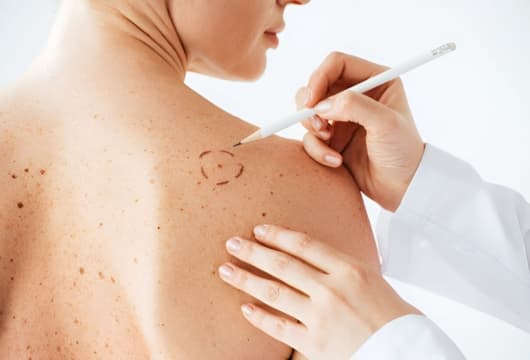 Dermatología en Santander